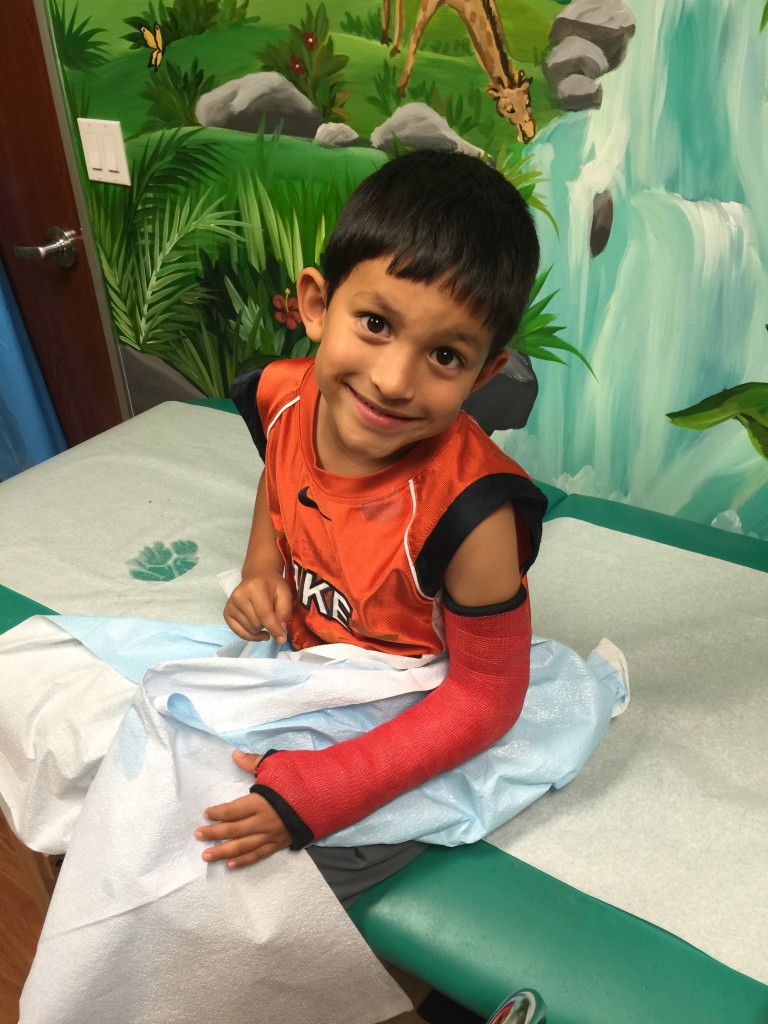 Small boy showing off a brand new red arm cast.